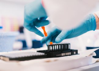 Gesundheitsstudie: Durchchecken lassen, der Forschung dienen Hamburg City Health Study: Forscher des UKE untersuchen 45.000 Hamburger