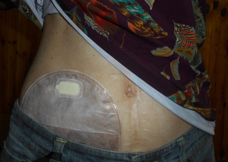 Gesina, die Stoma-App | FINK.HAMBURG