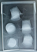 Verpackungen wurden mit Röntgenstrahlen durchleuchtet. Foto: Verbraucherzentrale Hamburg