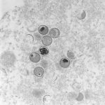 Affenpocken-Virus: Mittlerweile 16 Fälle in Hamburg Affenpocken Ultradünnschnitt