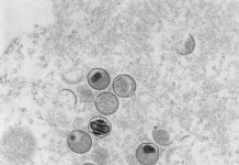 Affenpocken-Virus: Mittlerweile 16 Fälle in Hamburg Affenpocken Ultradünnschnitt