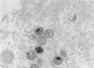 Affenpocken-Virus: Mittlerweile 16 Fälle in Hamburg Affenpocken Ultradünnschnitt